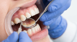 Was gegen Aphten Tun: Ursachen und was hilft - Arando Gesundheitsmagazin